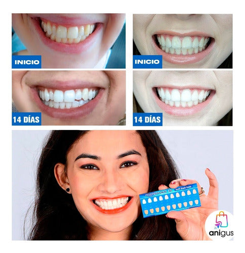 Advance Teeth Whitening Strips - Dental Whitening Gel Strips Nq 1