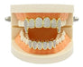 Jinao 18 Carat Gold Plated Grillz Set for Golden Teeth 3