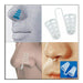 Nasal Dilator Respirator 1 Unit, Choose from 3 Models 4