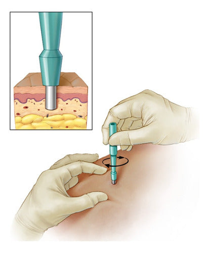 Surgi Cut Biopsy Punch 3