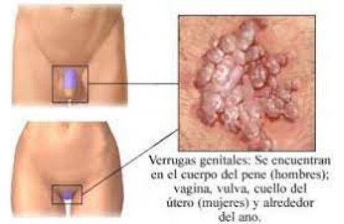 Ácido Tricloroacético 90 % X 100 Ml - Caflab - Ginecología - 4