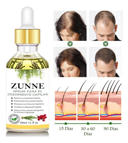 Zunne Hair Growth Serum - Proven Results!!! 0