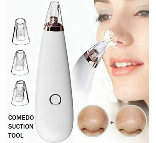 Limpiador Extractor Facial Poros Removedor Puntos Negros 1