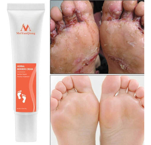 Bioaqua Herbal Foot Repair Cream for Fungal Infections and Onychomycosis 3