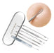 Mikobox Acne Blackhead Remover Tool Comedo Extractor 4