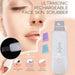 Espátula Facial Ultrasónica Recargable Peeling Skin Scrubber 1