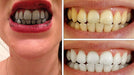 Blanqueador Dental Carbón Activado 2