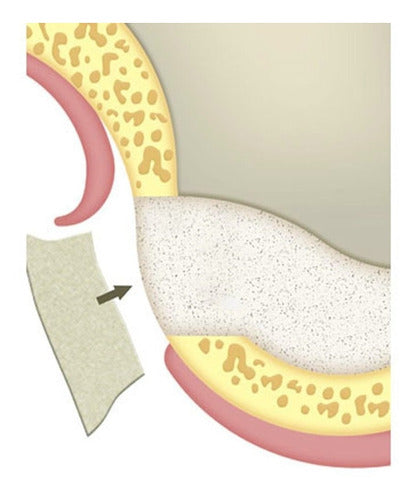 Membrana Reabsorbible De Colágeno 20mmx30mm Sus-mem Tissum 4