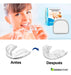 DERMASTORE Anti Bruxism Mouthguard with Thermoformable Case - Day and Night 3