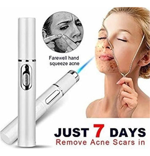 DD2 Laser Machine for Removing Tattoos, Acne, and Skin Blemishes - UV Light Skin Repair 3