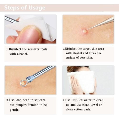 Acné Blackhead Remover Tool - Espinilla Comedón Extractor 3