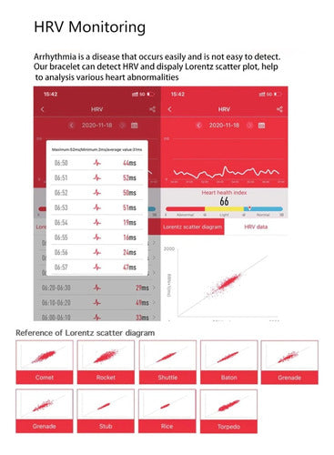 Smart ECG Bracelet H03 5