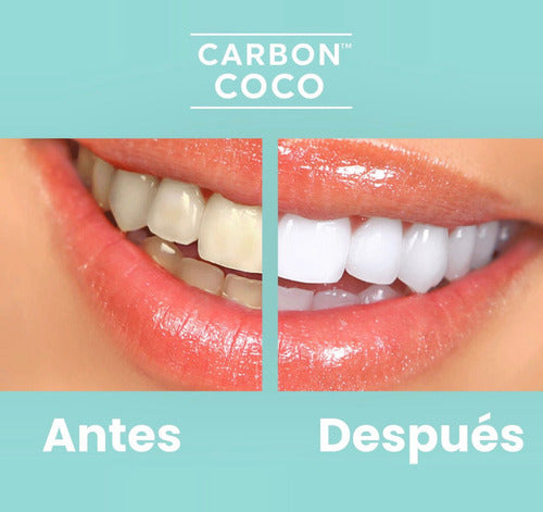 Blanqueador Dental Carbón Coco 1