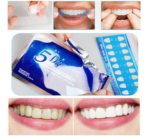 Renkai Teeth Whitening Kit with 5D Strips and Tongue Scraper 2