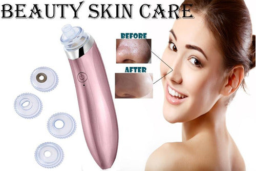 Beautiful Skin Acne Eliminator Rechargeable Xn Suction Absorption 6