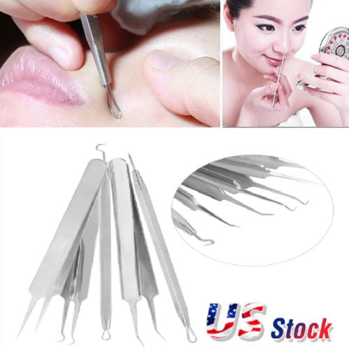 Extractor Tool System for Blackhead Removal 1