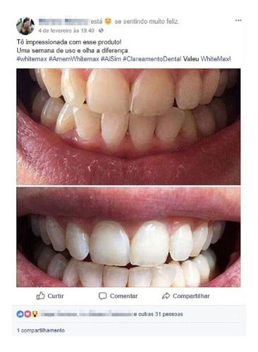 3 Branqueador Nos Dentes Clarear Os Dentes Artistas 5