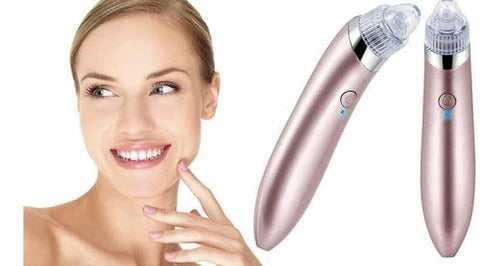 CELLSHOP Wireless Facial Blackhead Extractor 2