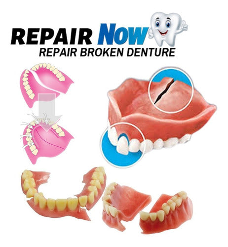 Repair Now Professional Denture Repair Kit 1