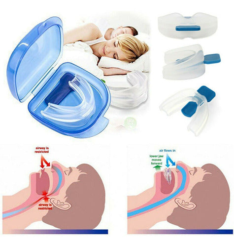 Aparelho Ortopedico Tratamento Ronco Apneia Sono 5