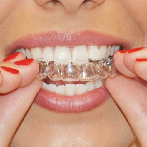 2 Pares Moldeira Termomoldável P/ Clareamento Dental Estojos 6