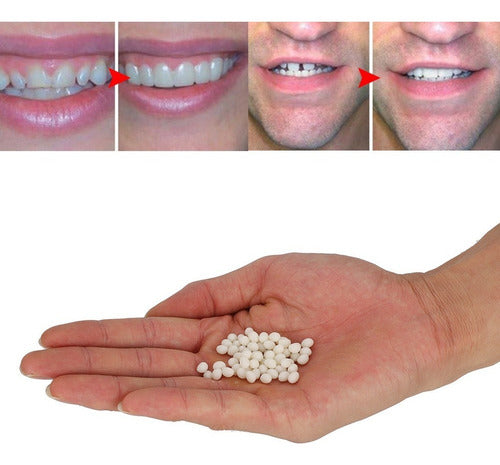 Reemplazo Temporal De Dientes: La Solución Rápida Y Fácil 3