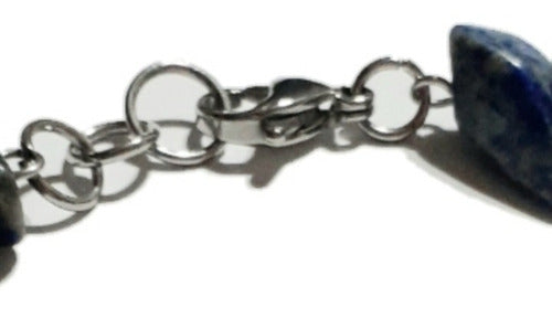10 Large Complete Surgical Steel Clasps Set 3