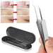 Extractor Tool System for Blackhead Removal 2