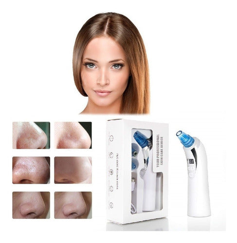 Cleaner Microdermabrasion Diamond Tip with LED Screen USB 2