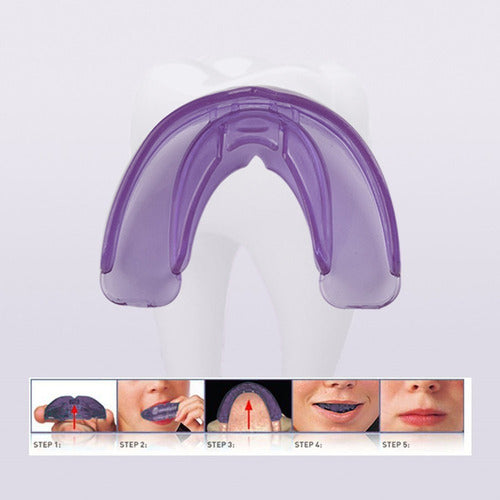 Aparelho Ortodôntico Dentário Alinhamento Dos Dentes 6