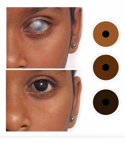 Generic Prosthetic Contact Lenses Annual Brown Tone with Iris 3