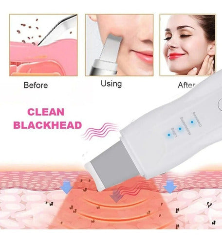 Espátula Facial Recargable Ultrasónica Scrubber Peeling Skin 5