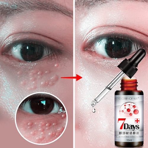 Círculos Na Pele, Bolsas Nos Olhos, Creme Para Os Olhos, Eli 0