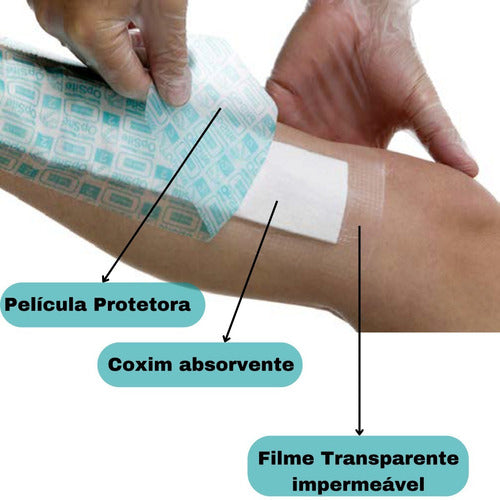 Curativo Com Compressa Opsite Post-op 30cm X 10cm - 02 Un 1