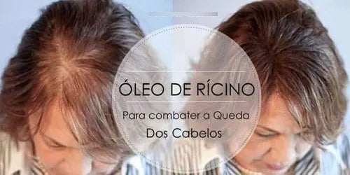 Aceite De Ricino Puro 30 Ml Pelo Pestañas Uñas 2