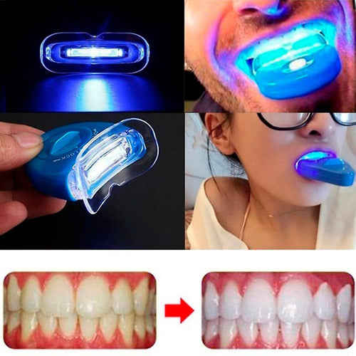 YSY Professional Teeth Whitening Kit with UV Light 4