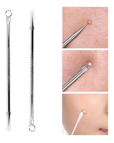 MELY Acne Extractor Kit - Blackhead and Pimple Removal Stainless Steel 0