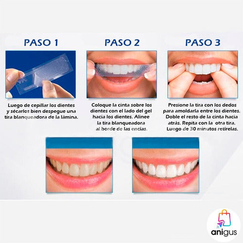 Advance Teeth Whitening Strips - Dental Whitening Gel Strips Nq 5