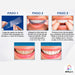 Advance Teeth Whitening Strips - Dental Whitening Gel Strips Nq 5