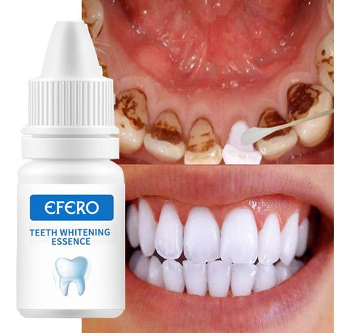 Essência Branqueadora De Dentes Efero Limpeza Higiene Oral R 0