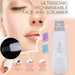 GLNS Ultrasonic Spatula Kit + Blackhead Remover + Nano Spray 2