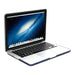 GMYLE Macbook Pro Retina 13 Hard Case 4