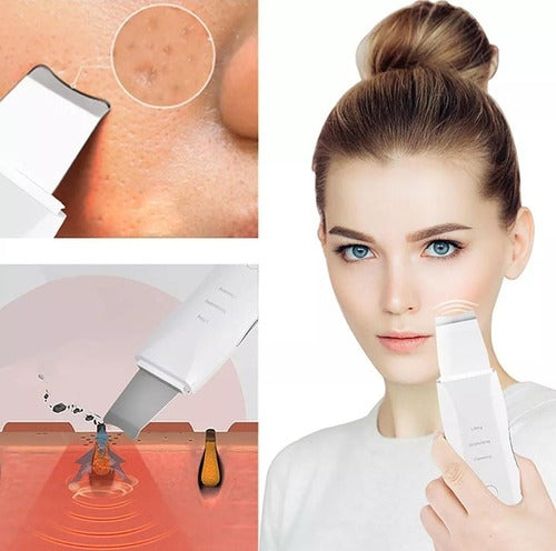 MUYE Facial Ultrasonic Peeling Exfoliator Cleaner 4