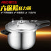 ASD Imported Pressure Cooker from Taiwan YC1824 | 24 cm Diameter 2