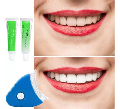 White Light Dental Whitening Gel Treatment for White Teeth 5