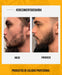Beard Growth Kit with Dermaroller and Bombamix Oil 2
