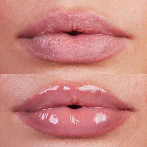 Complete BB Lips/Hidragloss Course with Microneedling 2