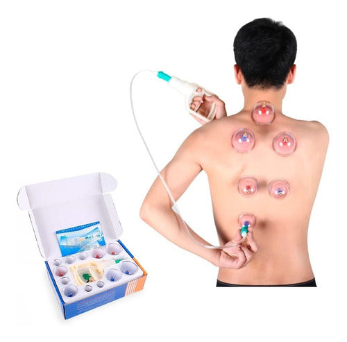 Set of 12 Fixed Chinese Cupping Therapy Suction Cups for Lymphatic Circulation Massage 0