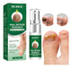 Renkai Anti-Fungal Nail Spray for Healthy Skin 0