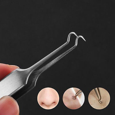 High Quality 7pcs Blackhead Acne Comedone Extractor Kit 3